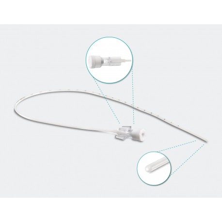 CATÉTER UMBILICAL ARTERIAL