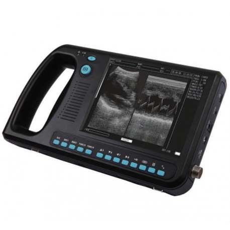 ultra-som scanners portáteis