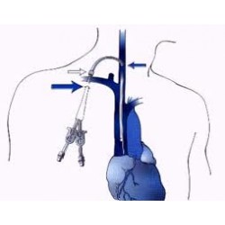 PRESSURIZADOR DE LÍQUIDOS KINNER FLEXIPRESS