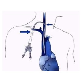 PRESSURIZADOR DE LÍQUIDOS KINNER FLEXIPRESS