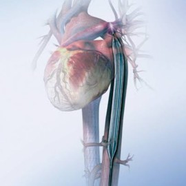 Balão intra-aórtico