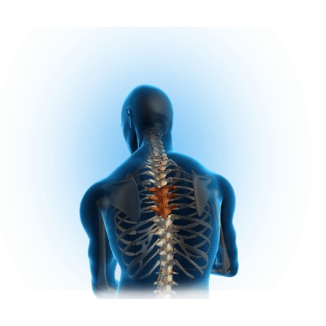 Cimento cirúrgico VERT-MAXX