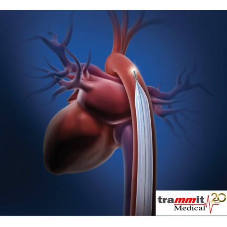 Cateter para Terapia de balão intra-aórtico